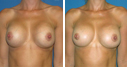 Before & After Photos